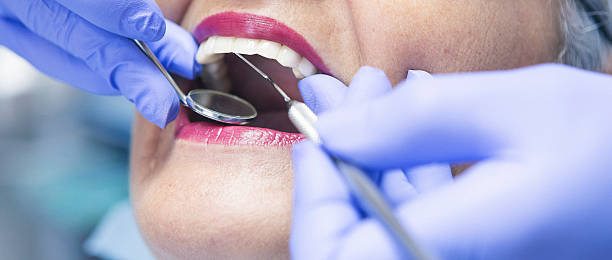 Best Emergency Dental Extractions in Chatsworth, IL